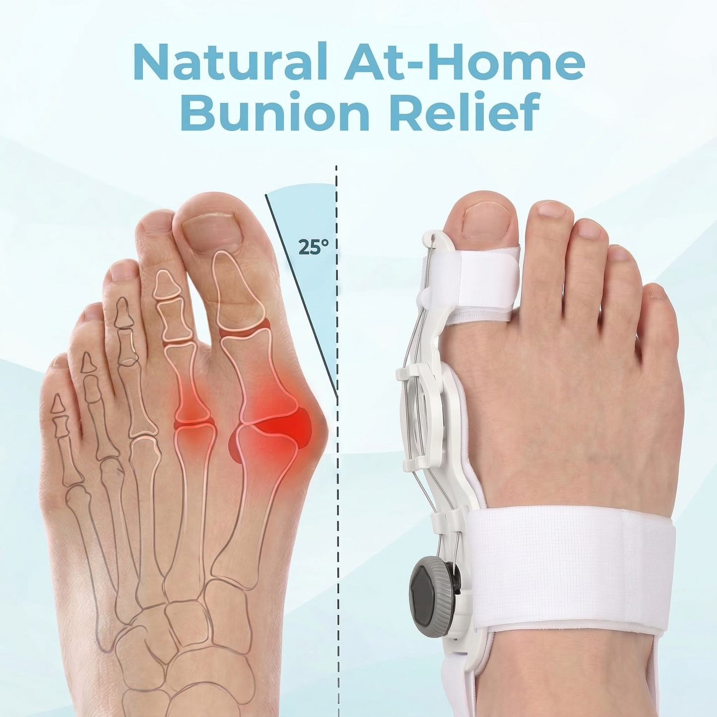 The Bunion Fix™