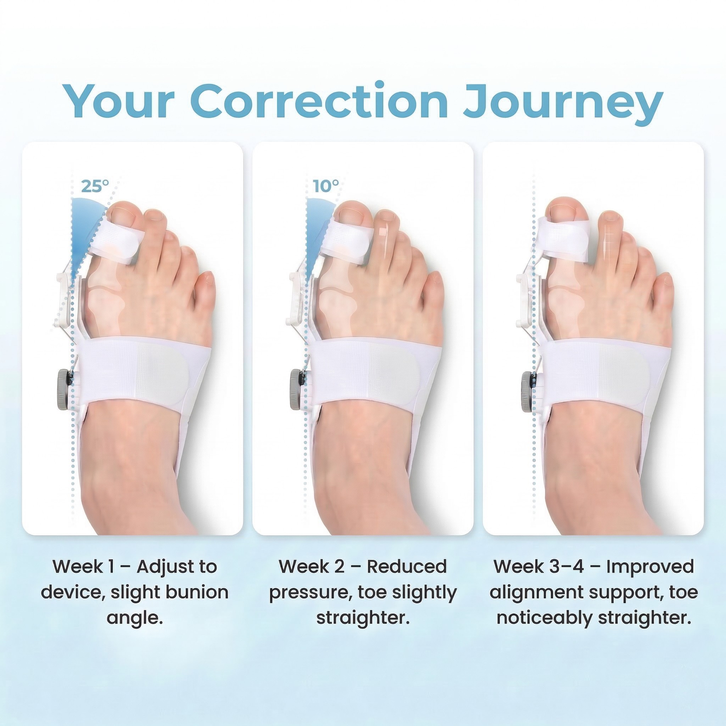 The Bunion Fix™