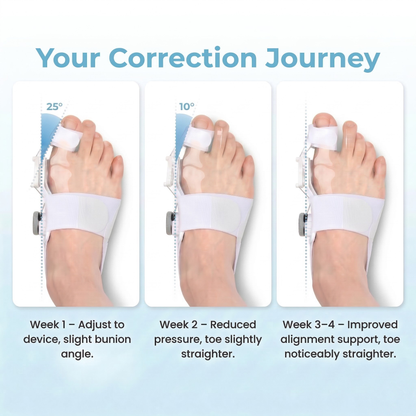 The Bunion Fix™